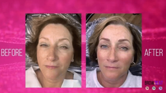 Permanent Makeup Cover Up Using Microblading: Dorothy’s Experience