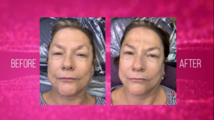 microblading-eyebrows-process