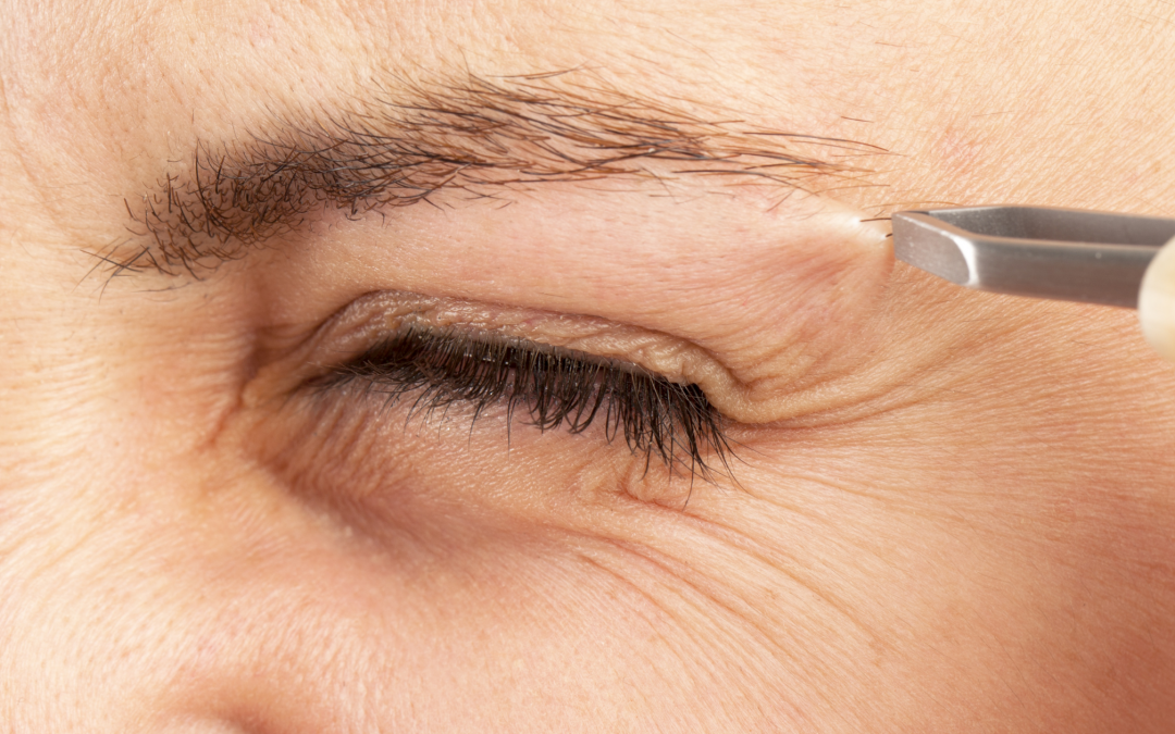 Skin Conditions And Factors That Affect Microblading Result