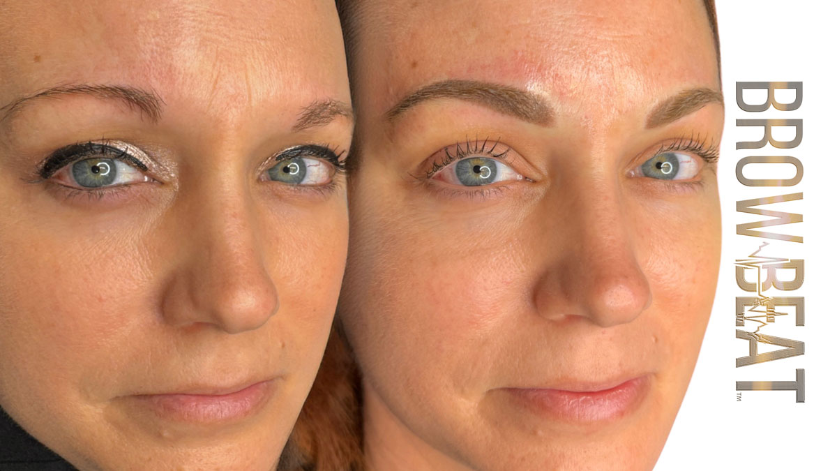 Gentle Micropigmentation Brow Appearance Enhancement For All Clients Low-impact cosmetic tattoo