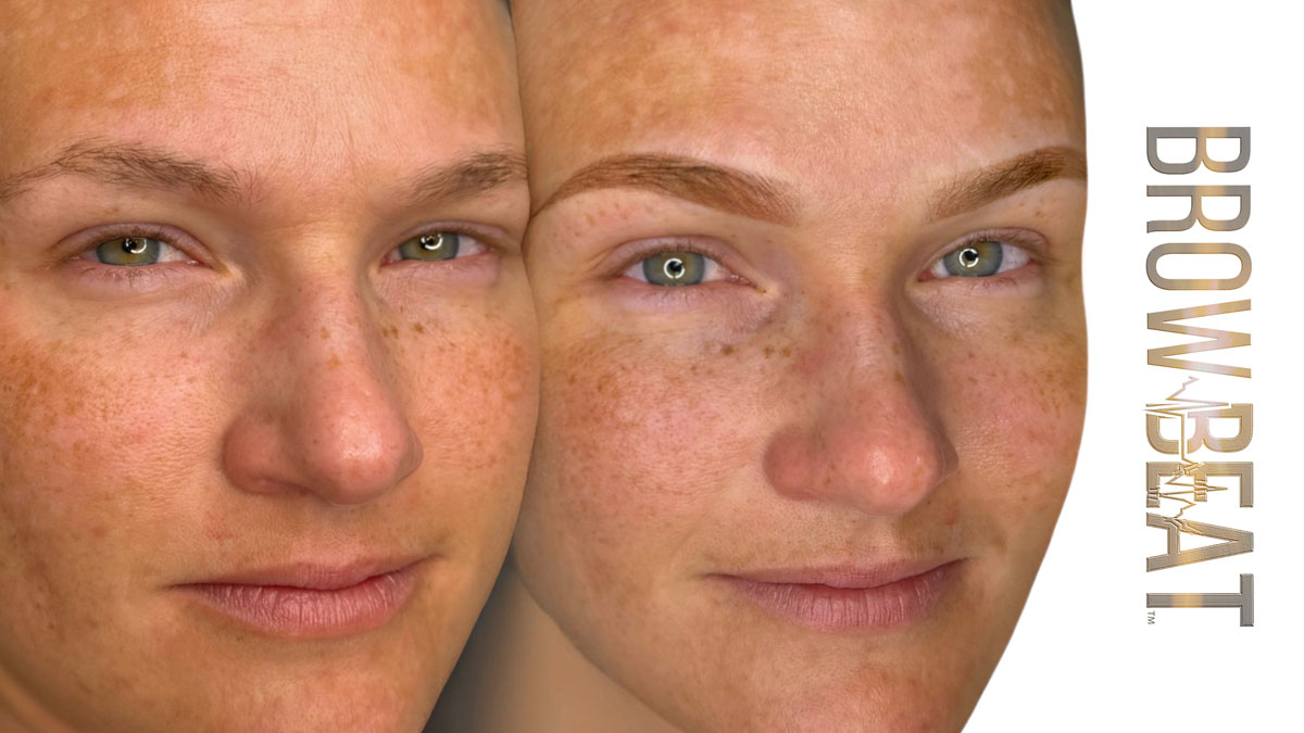 Gentle Micropigmentation Brow Tattoo For Beauty And Recovery Clients Gentle Micropigmentation Brow Tattoo – Dallas TX