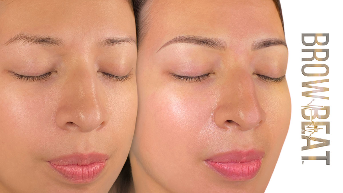 sensitive skin cosmetic tattoo paramedical cosmetic tattoo