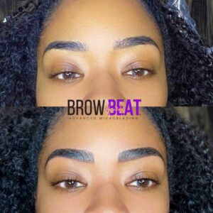 Correction Brows Before and After