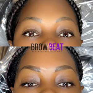Correction Brows Before and After