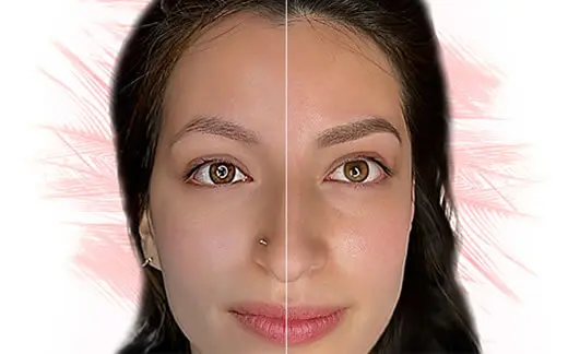 before and after