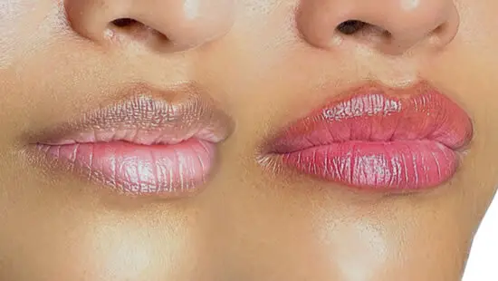 lipcoolmelanin
