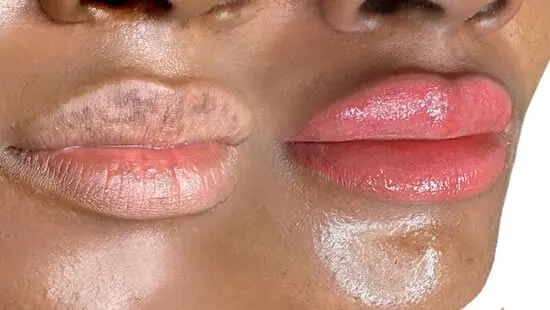 lippigmented