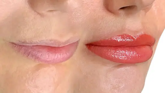 lipwarm