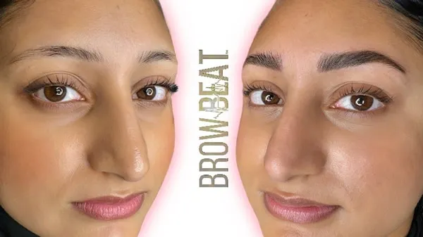Understanding Different Skin Types