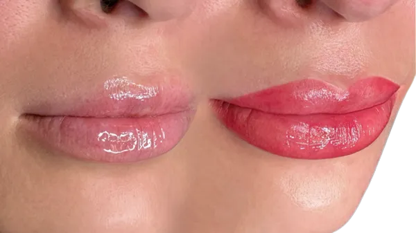 What is Lip Blushing?