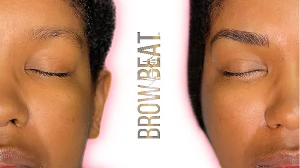 Understanding Different Skin Types