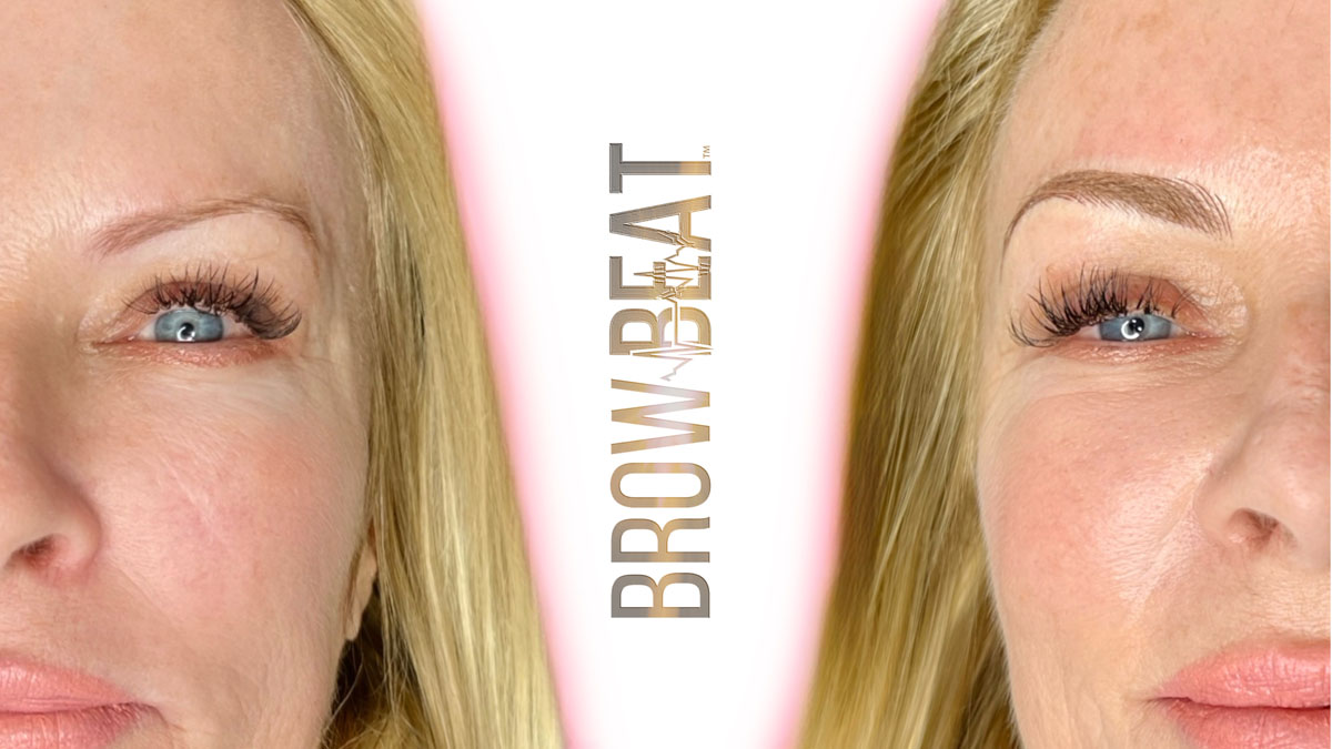 Naturally thin brows improved with combo brow tattoo