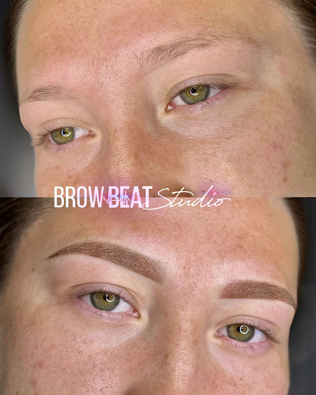 Brows in healing process