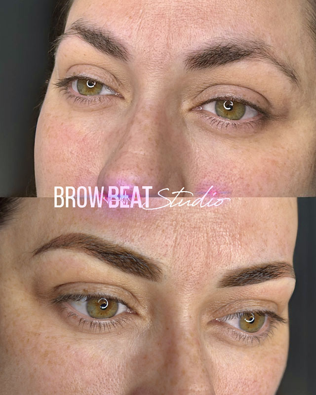 Uneven brows corrected with powder shading tattoo